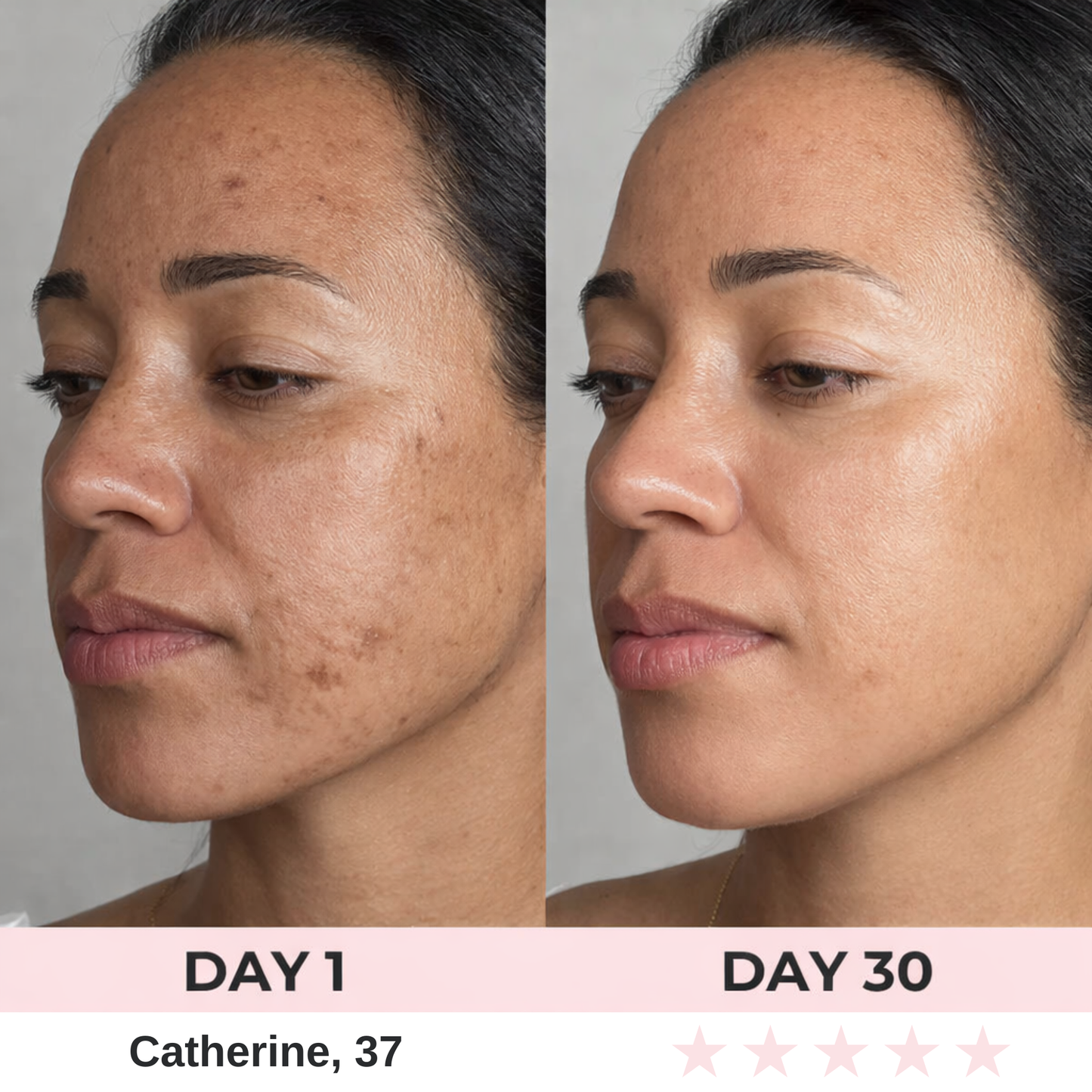 Luxurea™ Visculpt  7-in-1 LED Facial Sculptor
